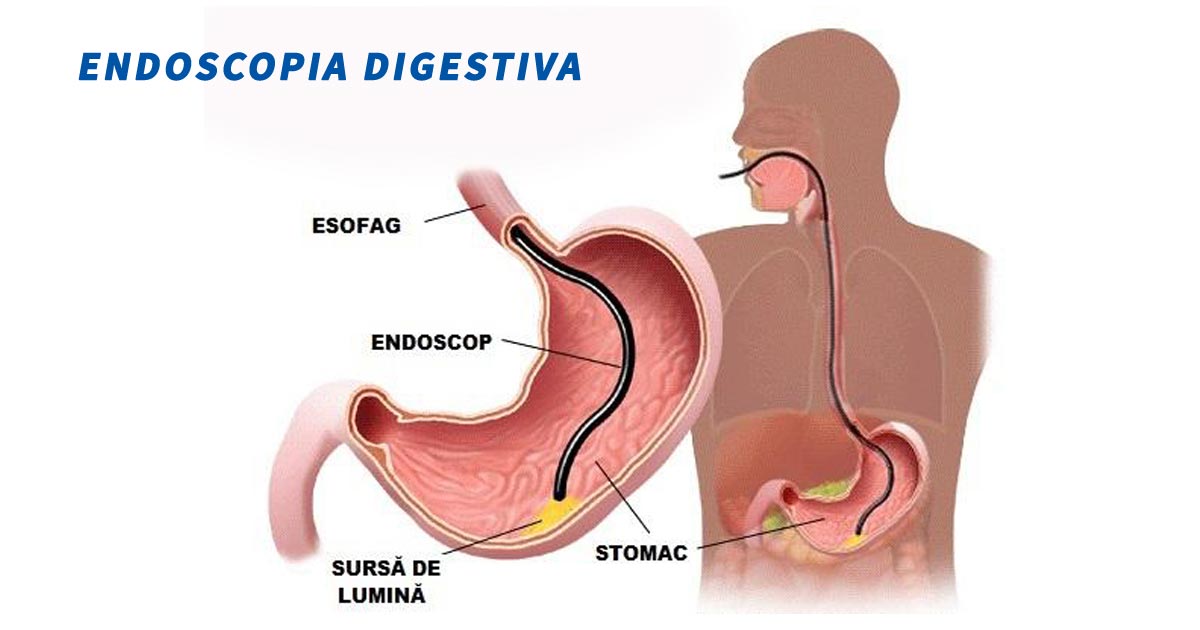 endoscopia-digestiva.jpg